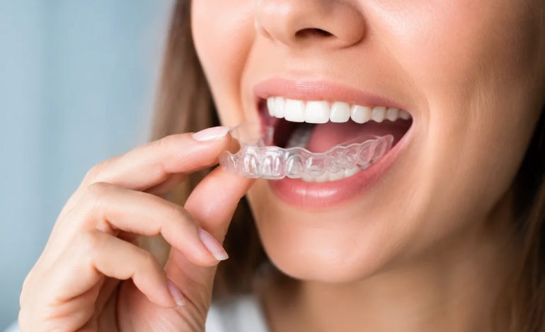 What Can You Expect Before, During, and After Your Invisalign Treatment